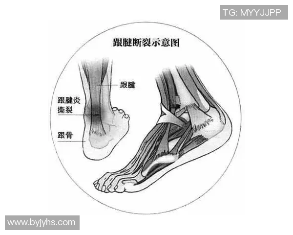 女单运动员伤病对比赛表现及职业生涯发展的深远影响分析